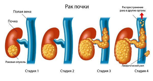 Гормональна терапія в онкології