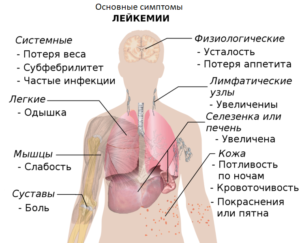 Скільки живуть з лейкозом? Причини лейкозу, аналізи, діагностика та лікування.